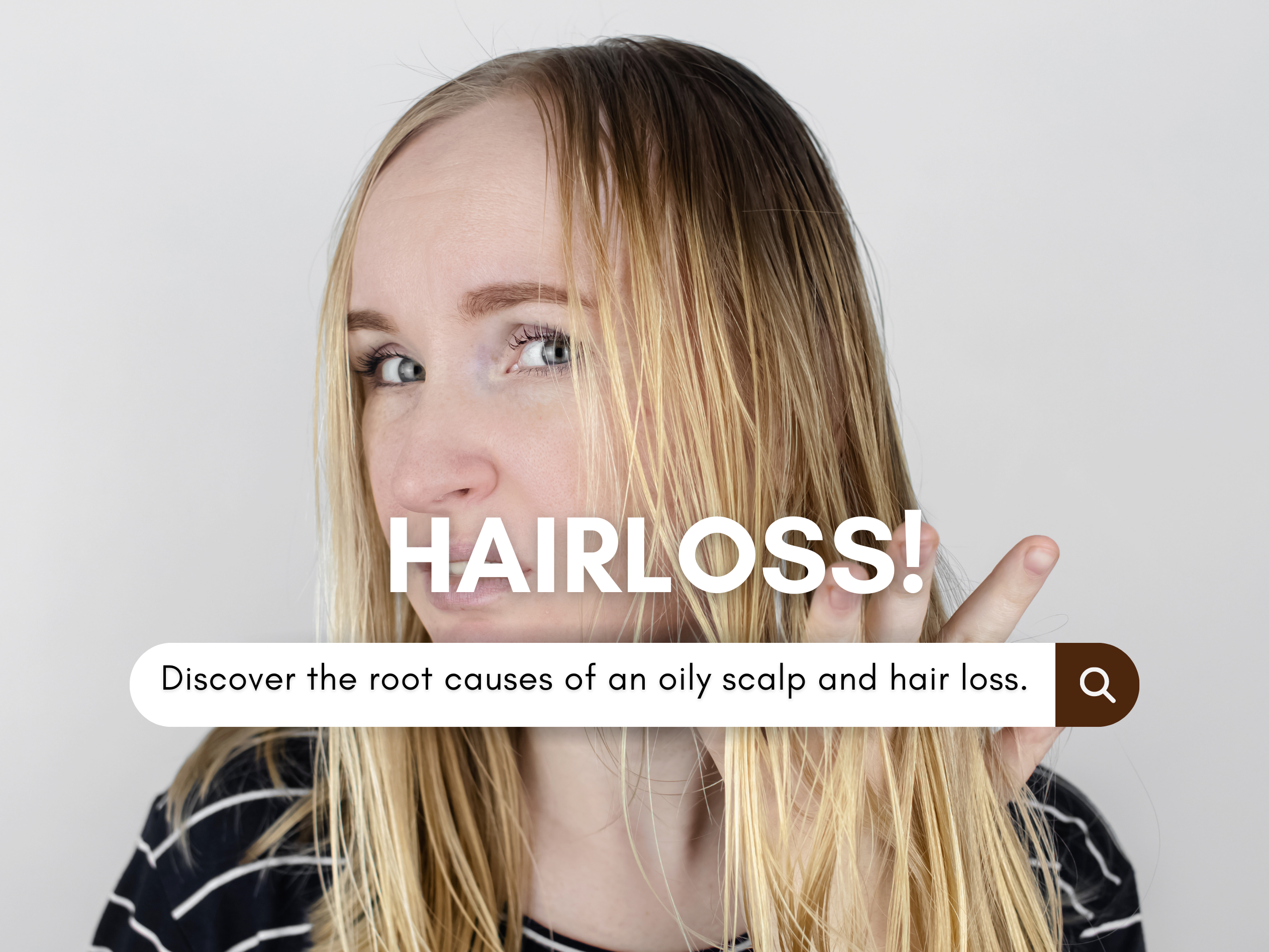 Hair loss online oily scalp