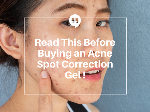 Read This Before Buying an Acne Spot Correction Gel