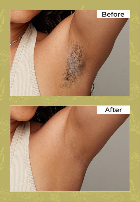 Herbal Bikini Wax Hair Removal Powder - 10 Min Wax
