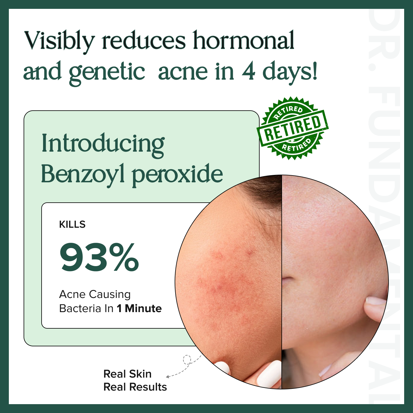 Salicylic 2% Niacinamide 5% Azelaic 5% Glass Skin Serum