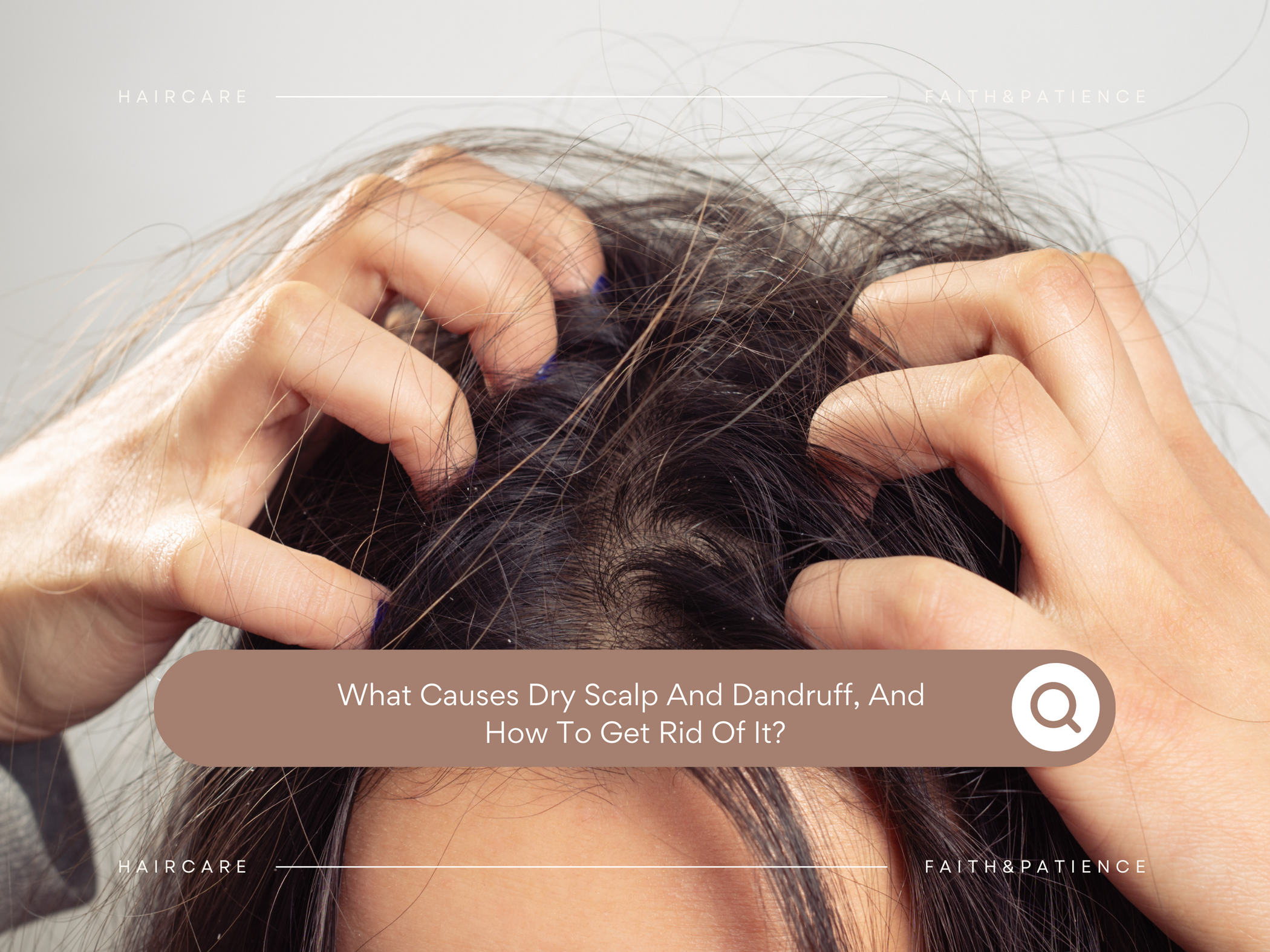 What Causes Dry Scalp And Dandruff And How To Get Rid Of It - FAITH