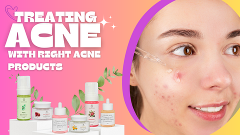 Treating Acne with the Right Anti-Acne Products