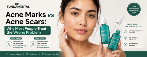 acne-marks-vs-acne-scars