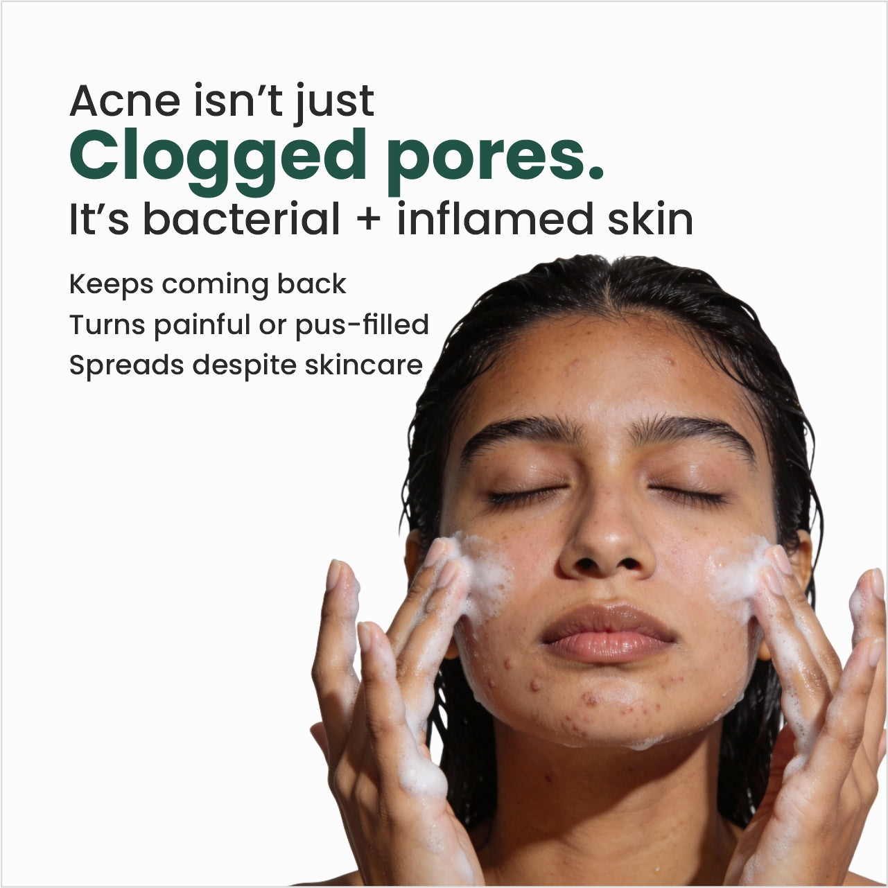 N0.1 Dermaclar Oxy Acne Cleanser