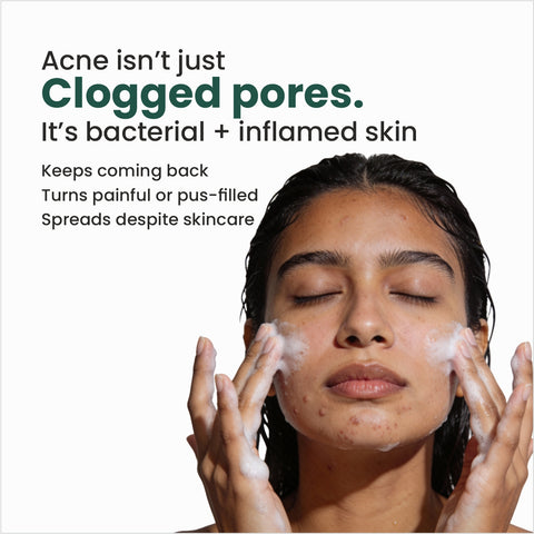 N0.1 Dermaclar Oxy Acne Cleanser