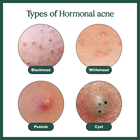 4% Tranexamic Acid 10% Niacinamide Clarifying Face Serum