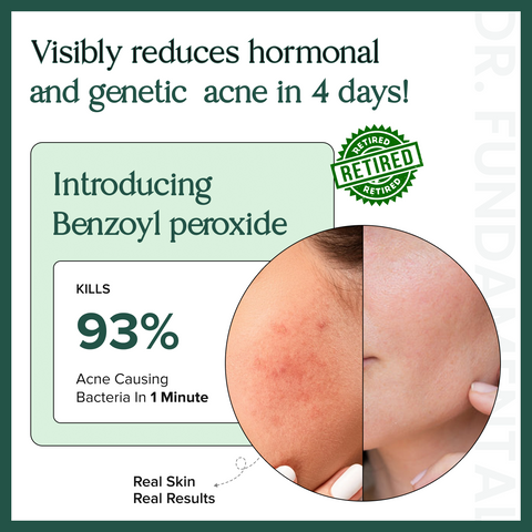 4% Tranexamic Acid 10% Niacinamide Clarifying Face Serum