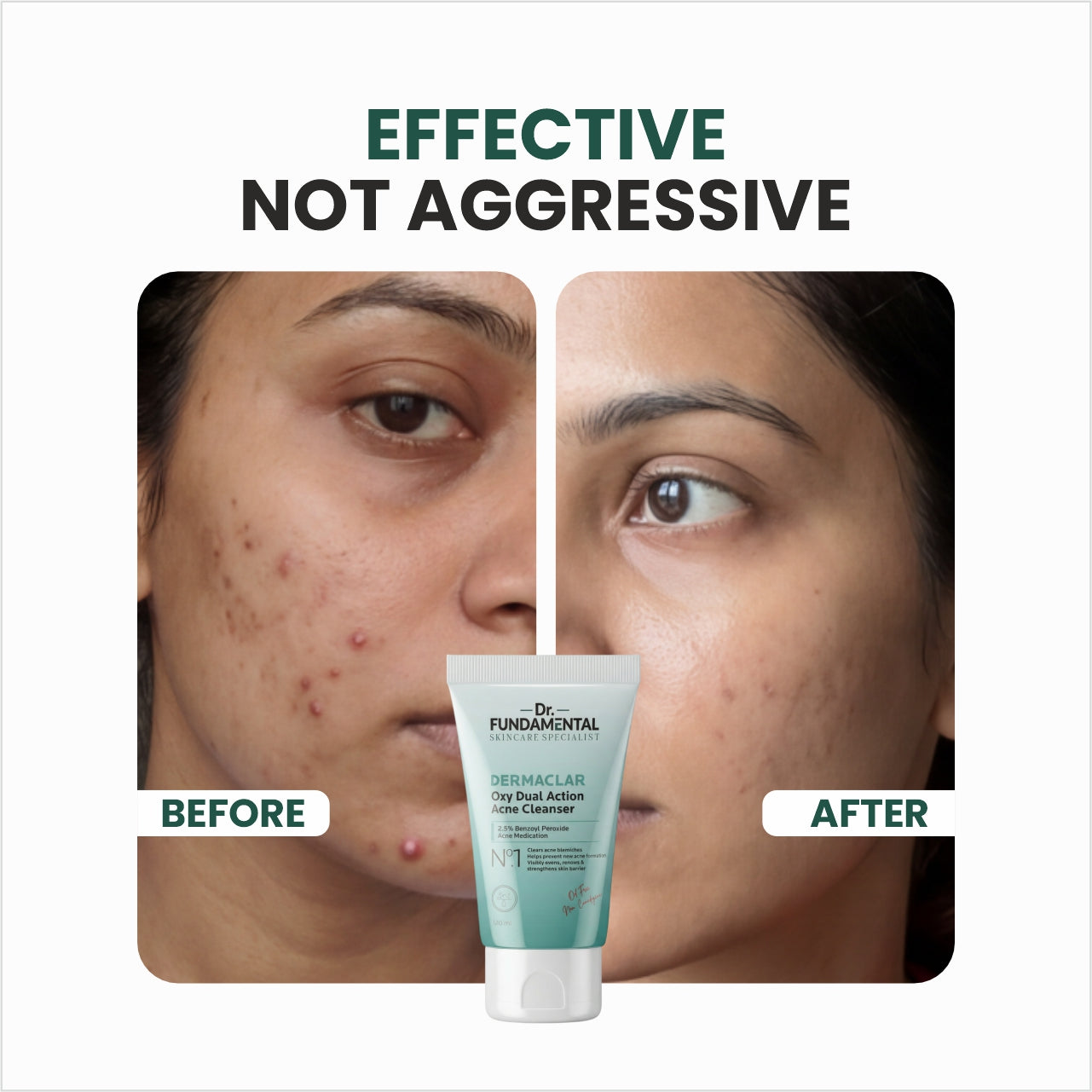 N0.1 Dermaclar Oxy Acne Cleanser